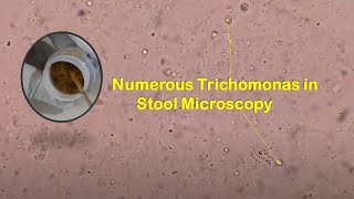 Live Parasites in Stool Microscopy [upl. by Eseuqcaj346]