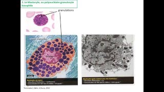 La réaction inflammatoire TS [upl. by Orgel]