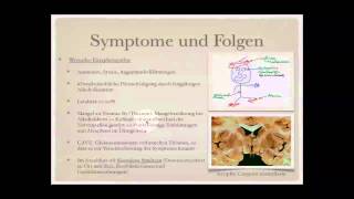 Sucht Alkohol Medikamente und Drogen Teil 88 [upl. by Mart991]