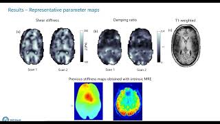 Estimating the viscoelastic properties of the brain using intrinsic MRE at 7T [upl. by Sucramad]