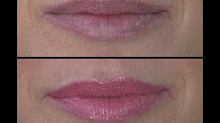 Quick Fix for Lip Wrinkles [upl. by Uella]