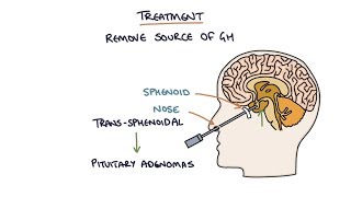 Understanding Acromegaly [upl. by Ervin962]