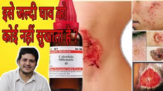 Calendula Mother tincture ka use ghav me kaise kare [upl. by Ylhsa]