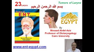 Larynx 3 Mosaad AbdelAziz Tumors of Larynx [upl. by Opalina861]