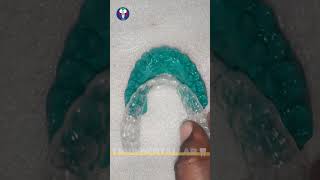 Toothsi  Dentist Lab World  Orthodontics Teeth Treatment  Painless  Tamil Dental Lab🦷dentallab [upl. by Sofie558]