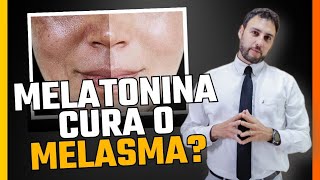 Melatonina cura o Melasma [upl. by Parry]