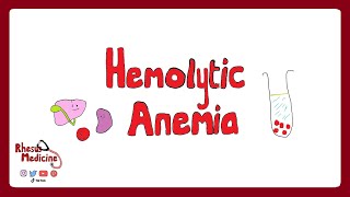 HEMOLYTIC ANEMIA Extravascular v Intravascular Clinical Features Diagnosis Coombs Test  Rhesus [upl. by Merry]