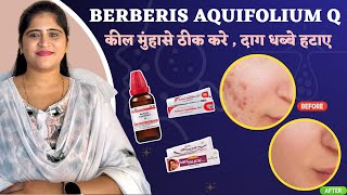 Berberis Aquifolium Q for Acne amp Pigmentation Best Homeopathic Medicine  Dr Arwa Bohra [upl. by Ilrebmyk]