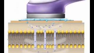 UltraschallVitalwellentherapie mit Vsonic [upl. by Ydne]