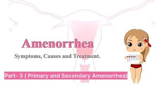 Amenorrhea part 3 primary Amenorrhea  secondary amenorrhea [upl. by Ynahpets]