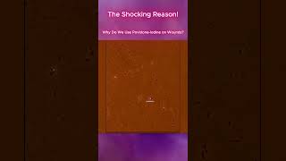 Why Do We Use PovidoneIodine on Wounds [upl. by Kcirdderf671]
