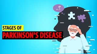 Stages of Parkinsons disease [upl. by Oicangi]