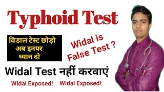 Widal Test In Hindi  Enteric Fever Test Report  विडाल टेस्ट रिपोर्ट नहीं Is False Positive test [upl. by Asiralc694]