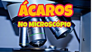 ÁCAROS NO MICROSCÓPIO VÍDEO INCRÍVEL [upl. by Friede]