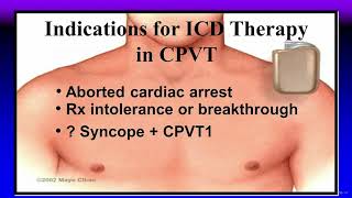 Cardiac Channelopathies Who Needs an ICD [upl. by Mont]