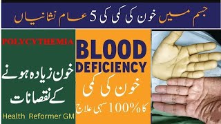 Anemia causessymptoms and treatement urdu hindi Khoon ki kami ka ilagHow to improve hemoglobin [upl. by Nerb]