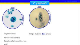 Entamoeba gingivalis [upl. by Narba]