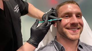 BROTOX MALE BOTOX INJECTIONS TO DECREASE WRINKLES amp FINE LINES ON FOREHEAD amp EYES  Dr Jason Emer [upl. by Imuyam490]