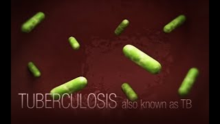 CDC Tuberculosis TB Transmission and Pathogenesis Video [upl. by Asilef237]