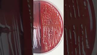 Identification of LactoseFermenting Bacteria on CLED Agar in Urine Culture [upl. by Schapira]