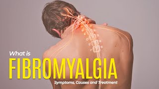 What is Fibromyalgia  Symptoms  Causes and Treatment Options [upl. by Aisilef298]