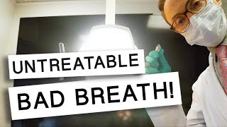 Bad Breath That CANT Be Treated [upl. by Ahsima]