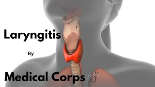 Laryngitis General OPD TopicsMedical Corps 🩺 [upl. by Talmud]