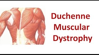 Duchenne Muscular Dystrophy [upl. by Atinnek]