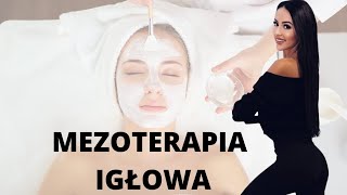 Mezoterapia Igłowa  cz6 [upl. by Eiuqnom]