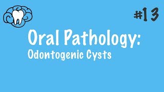 Oral Pathology  Odontogenic Cysts  INBDE ADAT [upl. by Bevis]