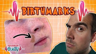 Operation Ouch  Brilliant Birthmarks  Human Skin [upl. by Pinebrook266]