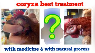 CORYZA treatment with medicine and natural process II CORYZA DIESE BEST TREATMENT II [upl. by Shandie]