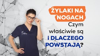 Żylaki na nogach – co musisz o nich wiedzieć 🦵 [upl. by Haibot894]