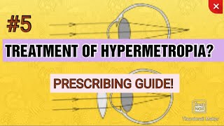 5 TREATMENT OF HYPERMETROPIA  Principles of hypermetropic correction  AAO guidelines [upl. by Trilbie222]