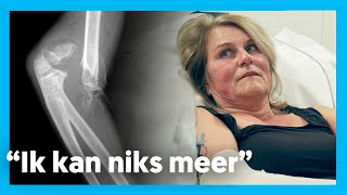 BEIDE ELLEBOGEN GEBROKEN  Op de spoed [upl. by Shelli]