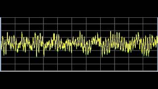 Arthritis 1 and 2  Rife Frequencies [upl. by Notluf]