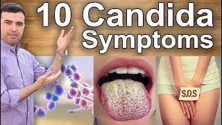 Signs and Symptoms You Have Candidiasis  10 Important Candida Infection Warnings [upl. by Stephania]