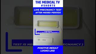 Positive pregnancy test short video pregnancytest livepregnancytest testshortvideo [upl. by Islean]