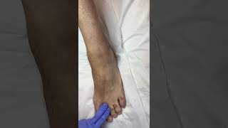 The most satisfying foot wax 😮‍💨 waxingexpert waxing waxer esthetician [upl. by Adamina]