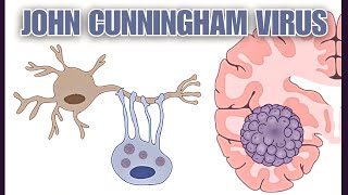 The JC Virus From Kidney Cells to Brain Destroyer Progressive Multifocal Leukoencephalopathy [upl. by Naitirb]