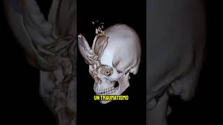 LE ENCAJARON UN RASTRILLO DE JARDINERÍA 😳🔪 radiologia shorts [upl. by Adihsar842]