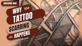 Why Tattoo Scarring HappensTattooing For Beginners [upl. by Bradford]