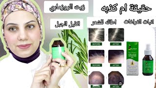 بعد استعمال ٣ شهور  رو افريكان لانبات وتطويل الشعر Raw African Follicle booster [upl. by Etiam]