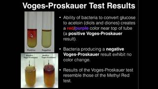 Microbiology VogesProskauer Test [upl. by Yromem323]