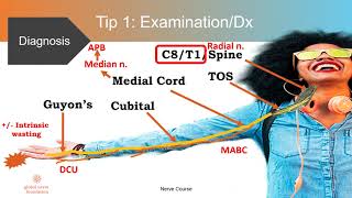 10 TIPS in dealing with Cubital Tunnel Syndrome [upl. by Stanleigh849]