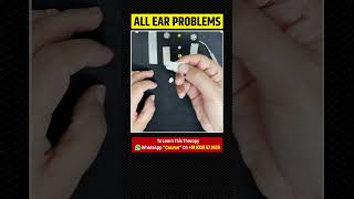 All Ears Problem Acupressure Treatment [upl. by Nelie499]