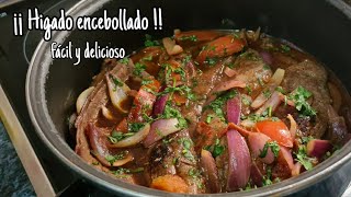 HIGADO ENCEBOLLADO  PERUANO  FÁCIL Y DELICIOSO [upl. by Mackoff]