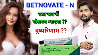 Betnovate n Cream honest review  Betnovate n lagane se kya hota hai  Betnovate n skin cream  aqh [upl. by Tiffie]