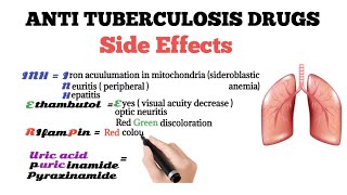 anti tuberculosis drugs side effects [upl. by Hannavas784]