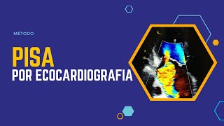 ✅Método PISA en Ecocardiografia [upl. by Anaig]